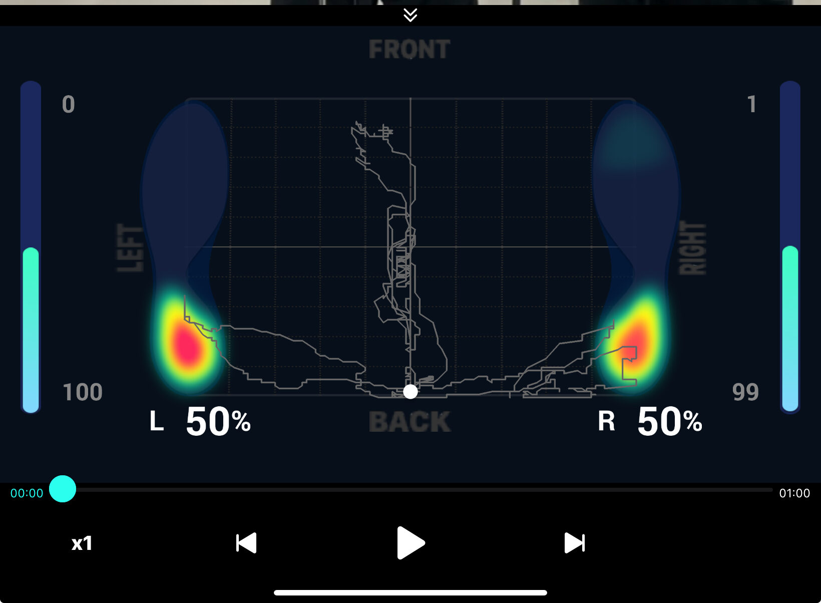 足底圧センサーと視覚入力を用いて感覚フィードバック療法を行っている様子